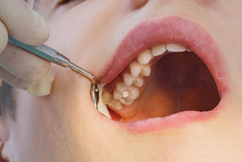 image of Googong Dental